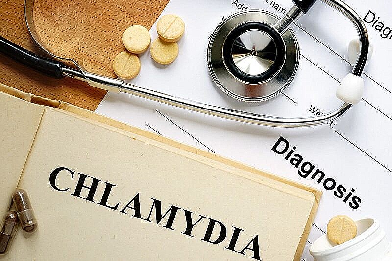 Симптомы и лечение хламидиоза у женщин