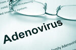 Аденовирусная инфекция: симптомы и лечение