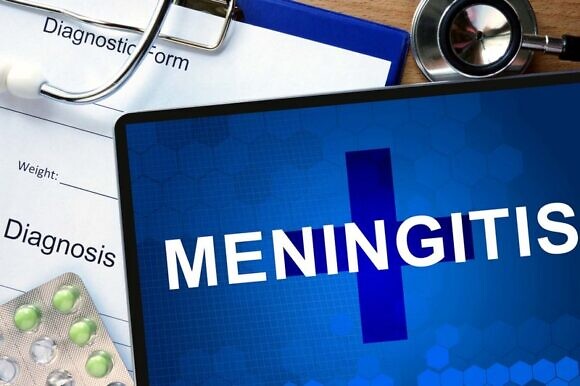 Вирусный менингит