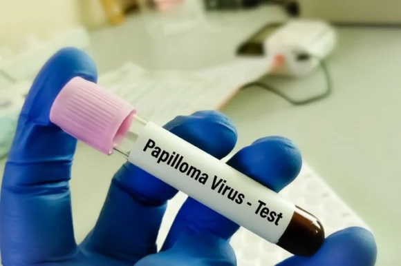 Папилломавирус человека: причины и лечение-5