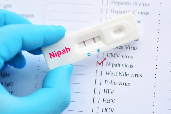 Что такое вирус Нипах