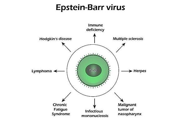 Какие болезни вызываются вирусными инфекциями и их лечение-4