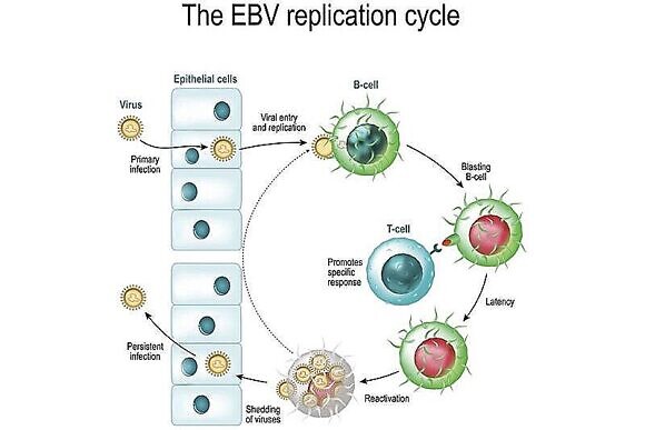 ВЭБ – вирус Эпштейна Барр-2