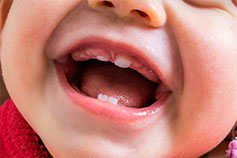 Первые зубки: как помочь малышу-1